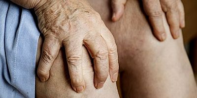 İltihaplı romatizma olarak da bilinen romatoid artrit hastalığı uzun süre tedavisiz bırakıldığında, eklemlerde kalıcı hasarlar bırakabiliyor